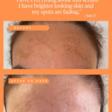 High Achiever Vitamin A Serum