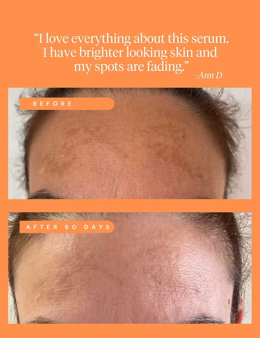 High Achiever Vitamin A Serum