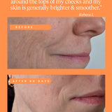High Achiever Vitamin A Serum
