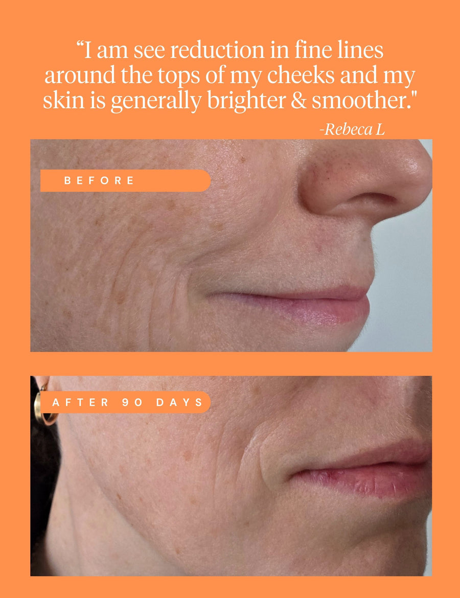 High Achiever Vitamin A Serum