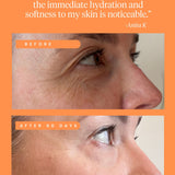 High Achiever Vitamin A Serum