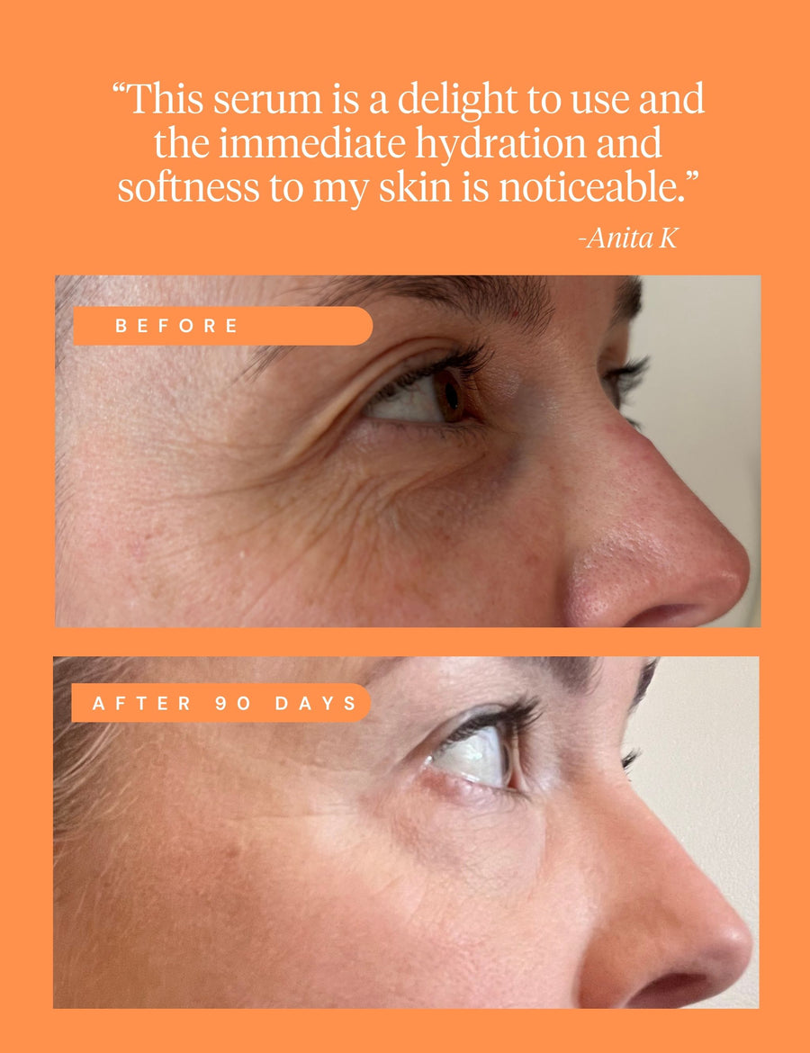 High Achiever Vitamin A Serum