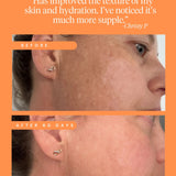 High Achiever Vitamin A Serum