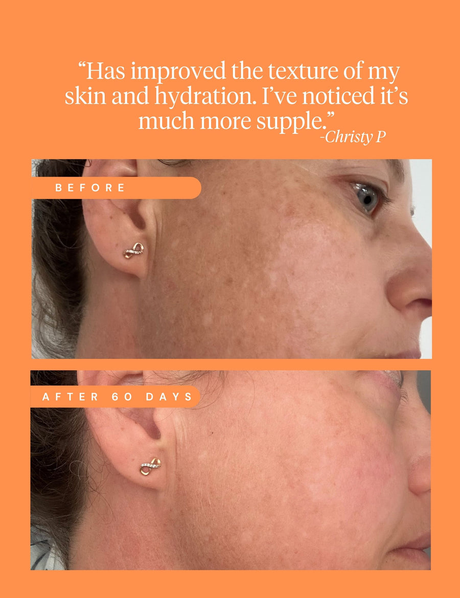 High Achiever Vitamin A Serum