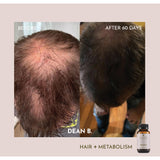 Hair + Metabolism