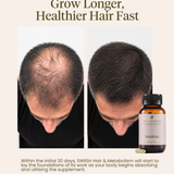 Hair + Metabolism